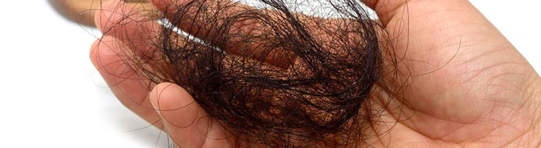Chute des cheveux et huiles essentielles