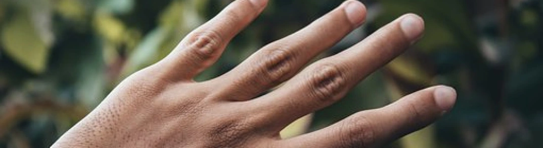 Mycoses des ongles