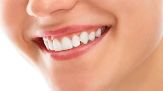 Dents blanches
