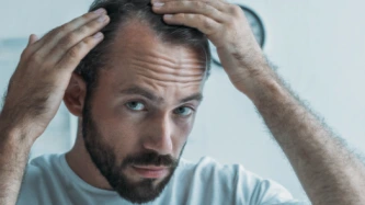 Alopécie & chute de cheveux