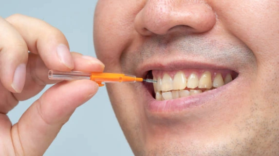 brossette interdentaire