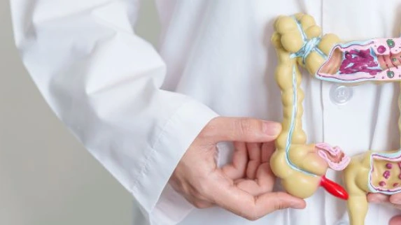 Syndrome de l'intestin irritable