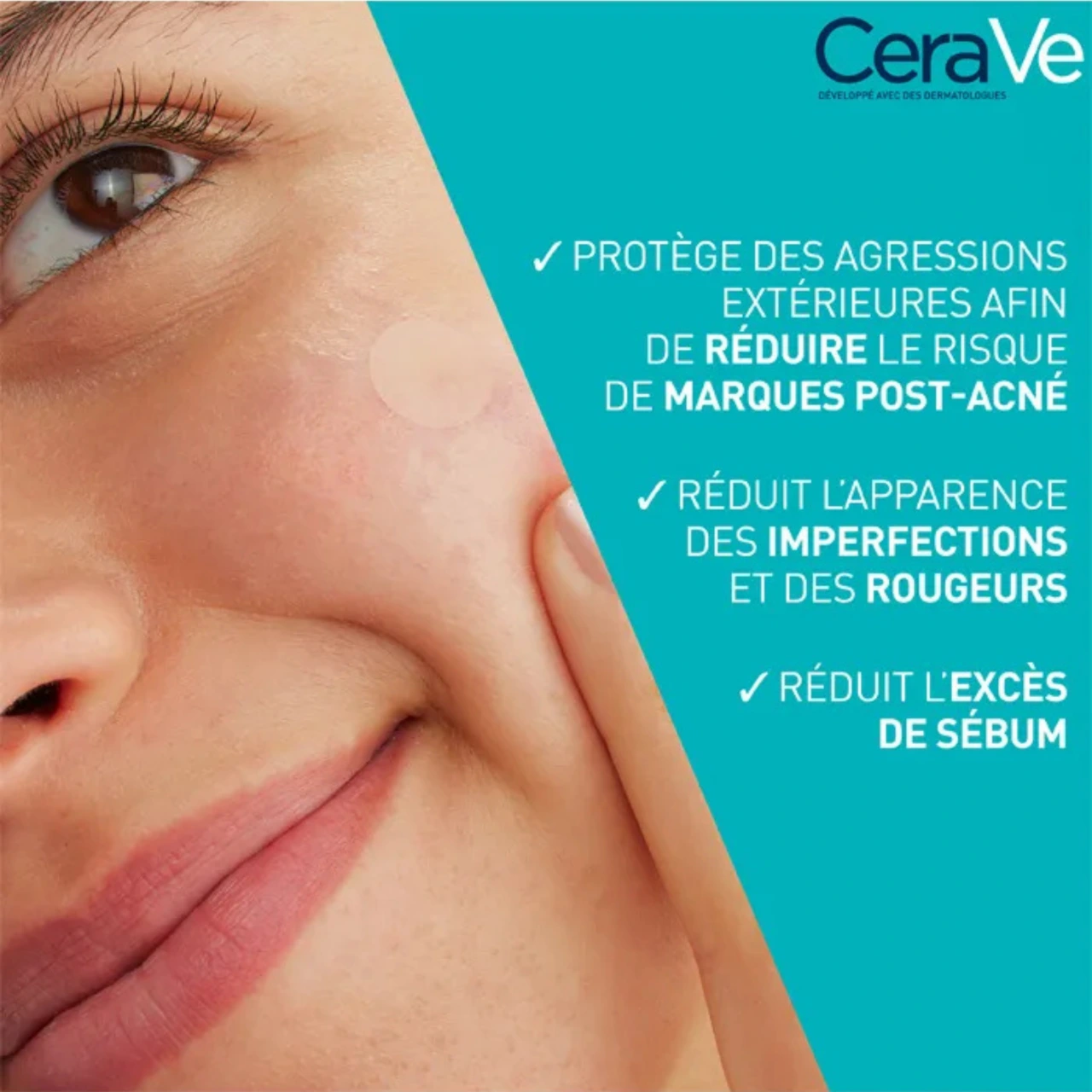 CeraVe Patchs Anti Imperfections - Vue 4