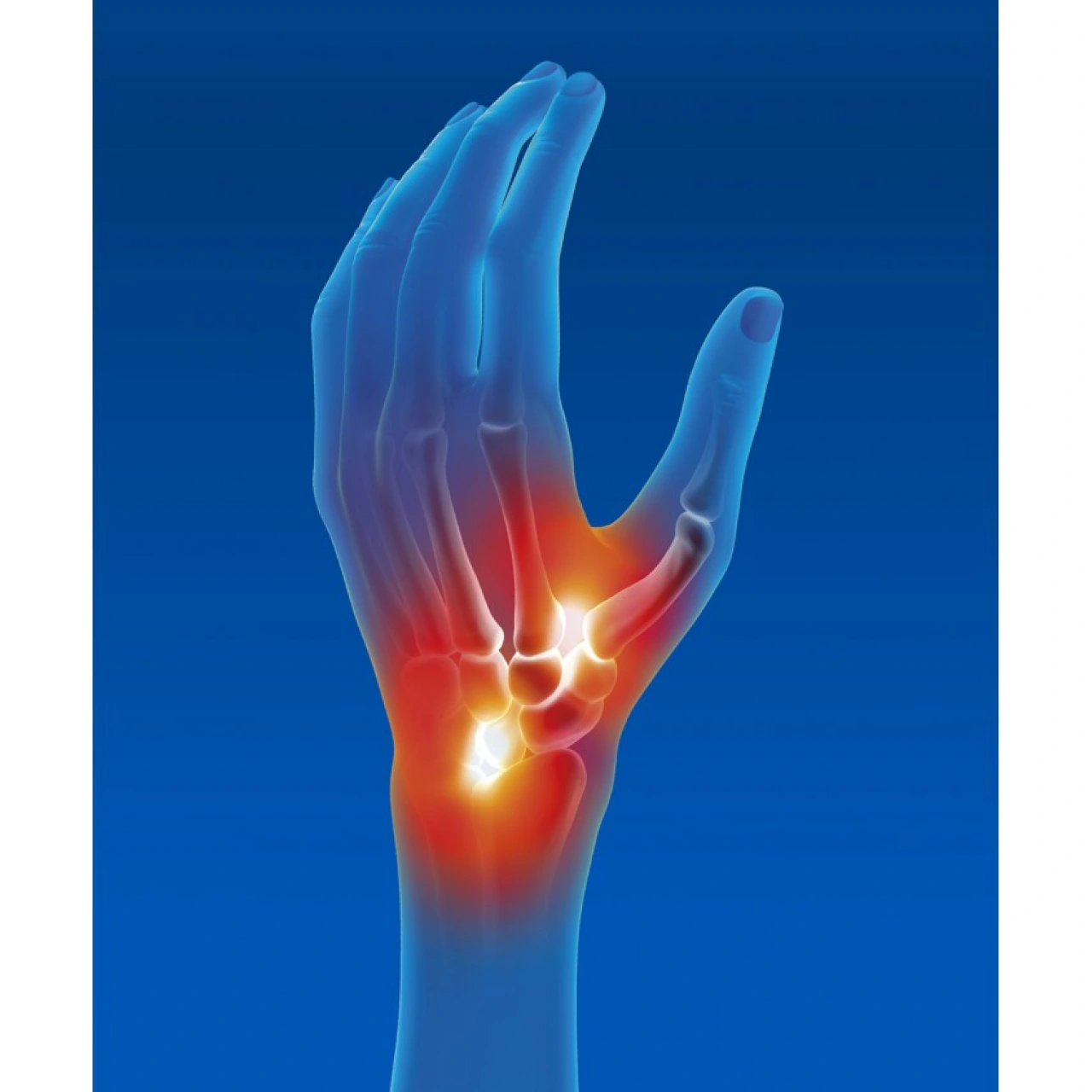Epitact Attelle Poignet Pouce d'Immobilisation - Vue 3