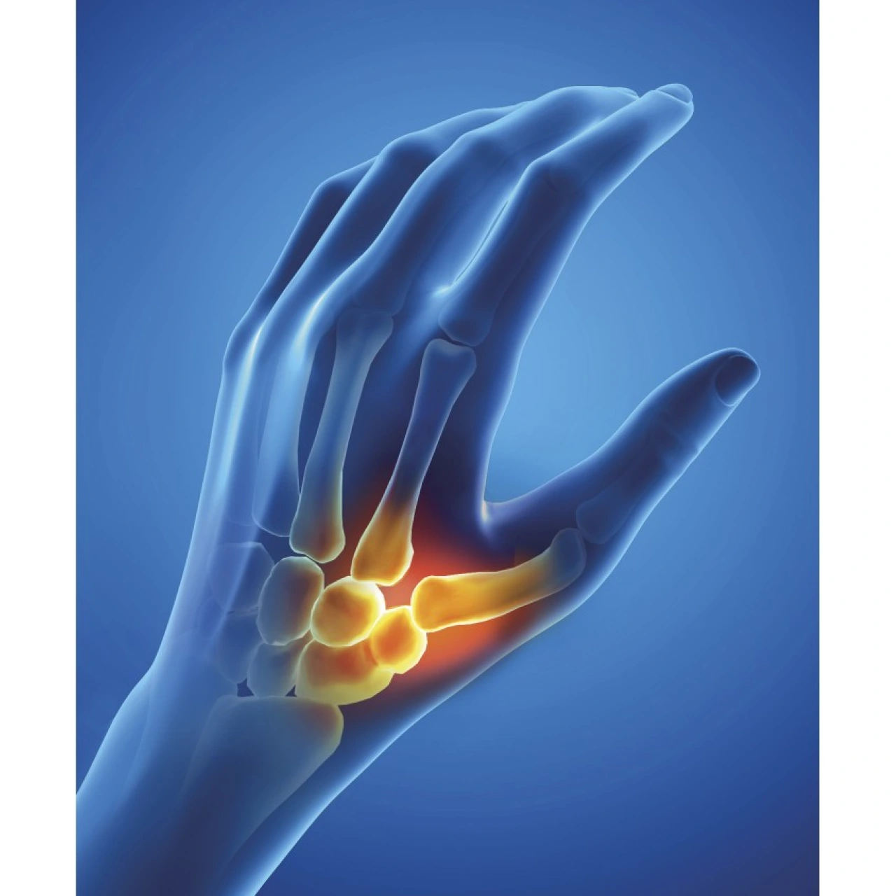 Epitact Orthèse de Pouce Souple d'Activité Rhizathrose - Vue 2