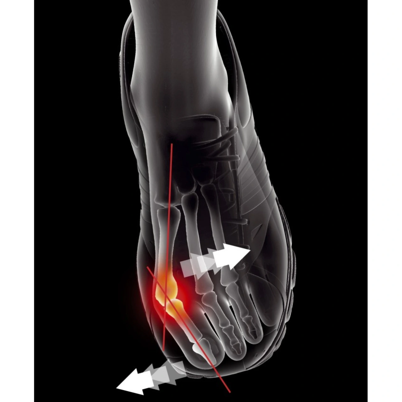 Epitact Orthèse Hallux Valgus - Vue 3