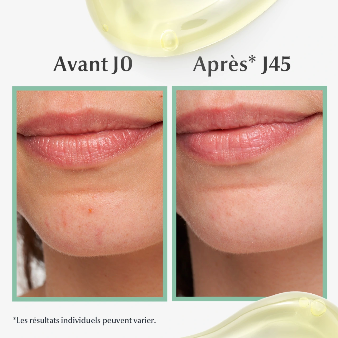 Eucerin DermoPure Sérum Triple Action - Vue 4