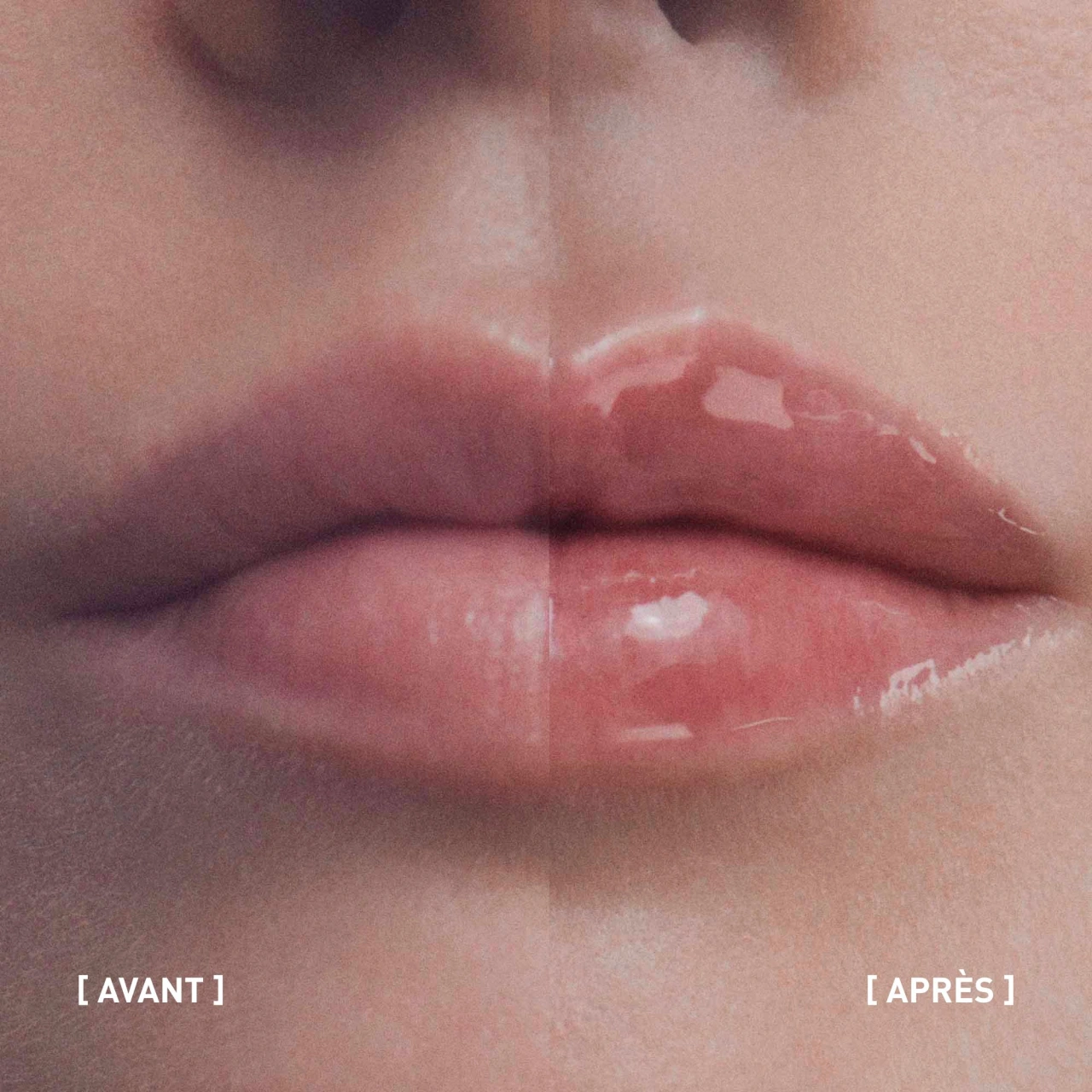 Filorga Hyalu-Filler Lips - Vue 8