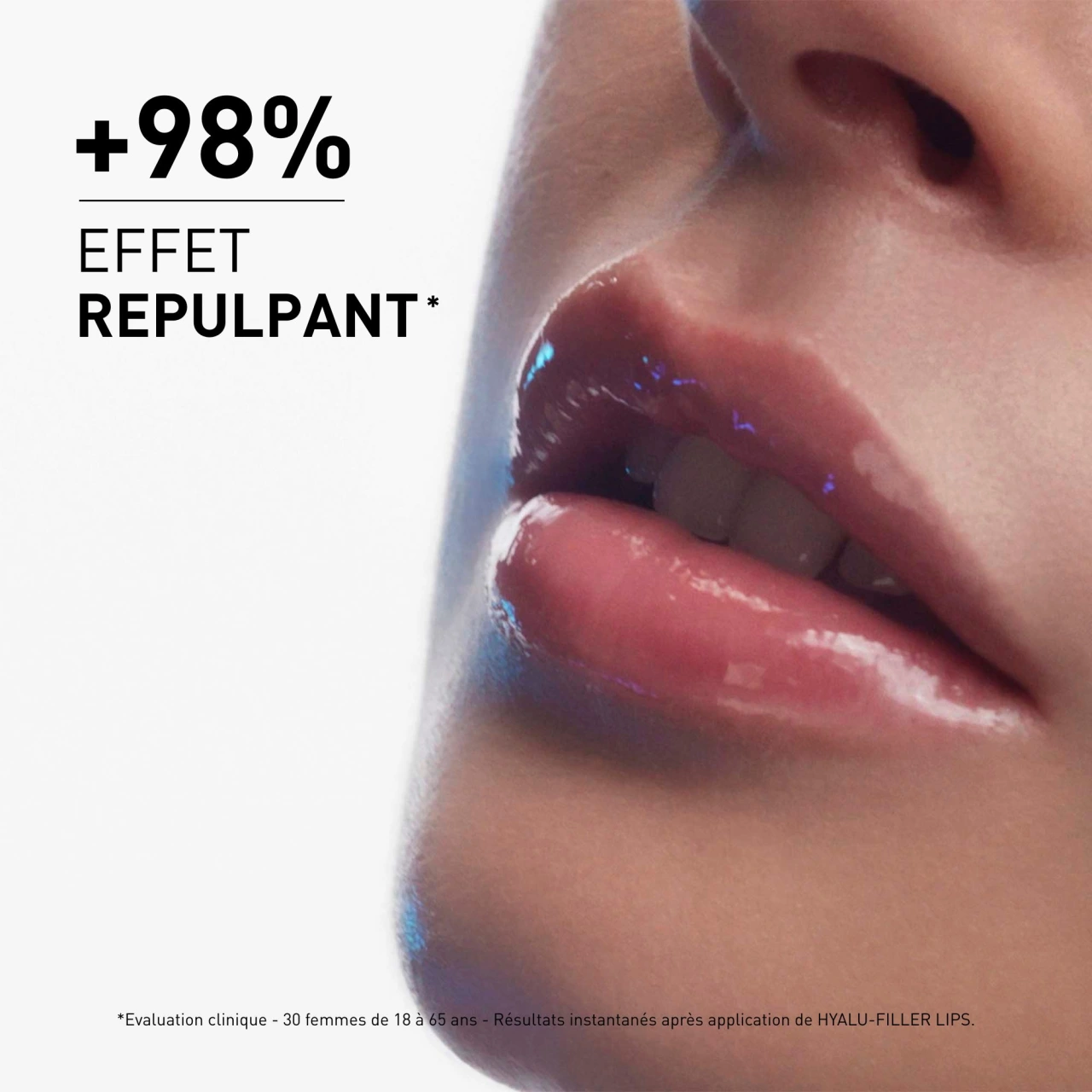 Filorga Hyalu-Filler Lips - Vue 9