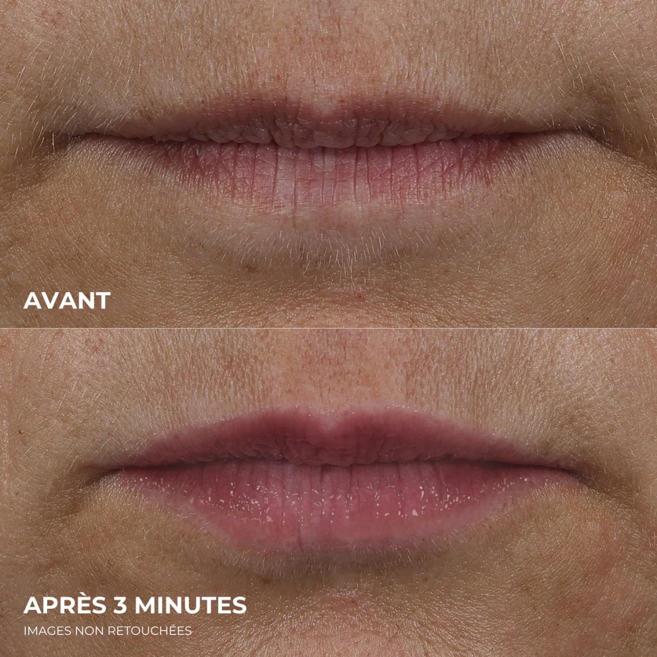 ROC Derm Correxion Volumateur Lèvres - Vue 4