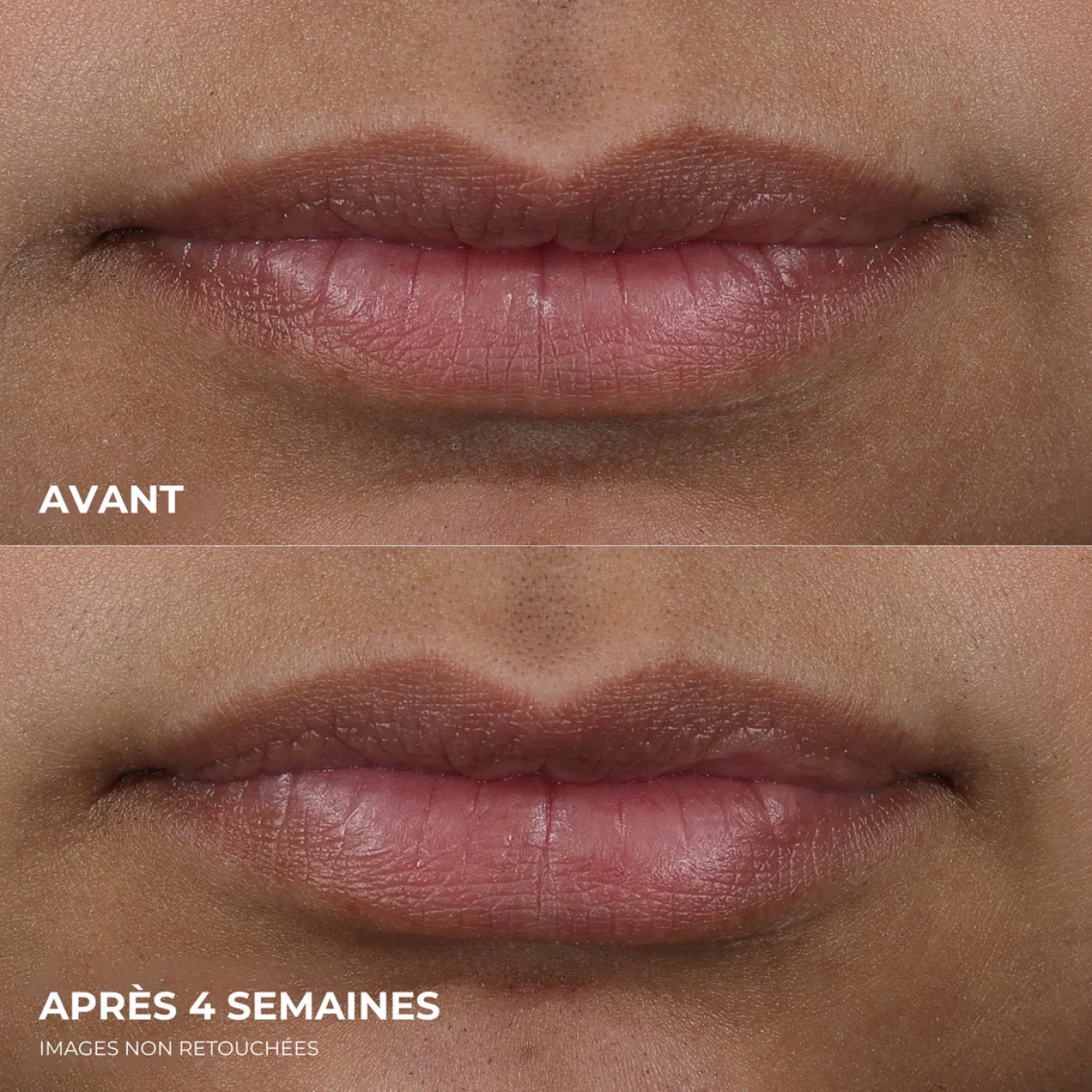 ROC Lip Volumizer - Vue 6