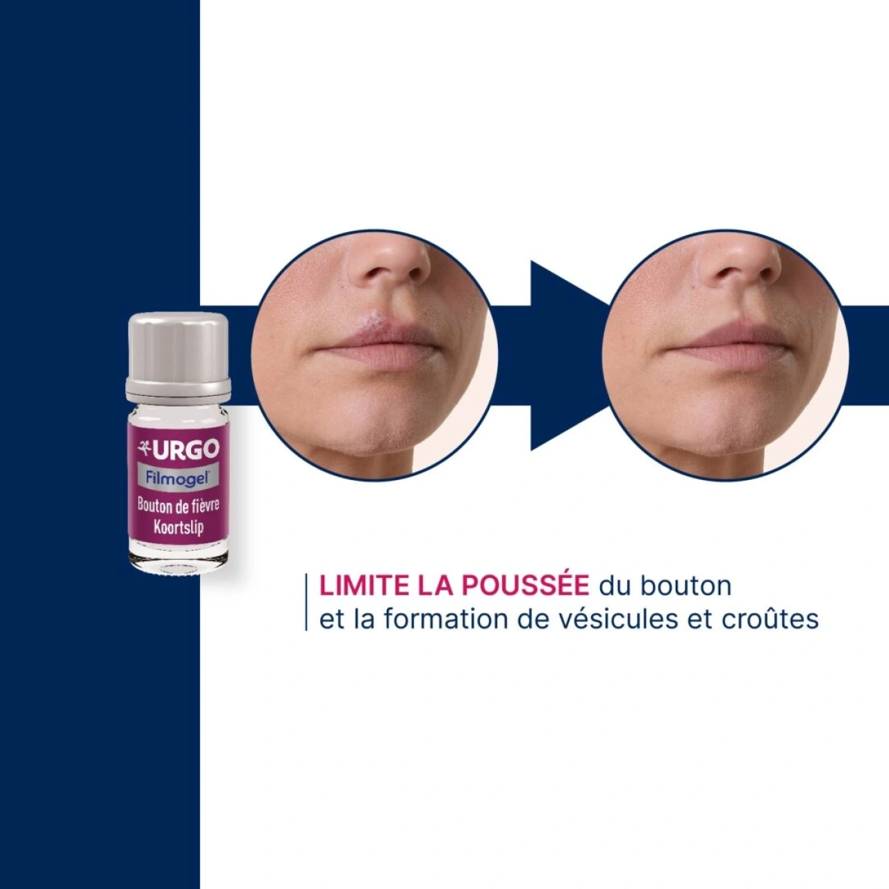 Urgo Filmogel Bouton de Fièvre - Vue 4