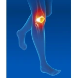 Epitact Genouillère Ligamentaire
