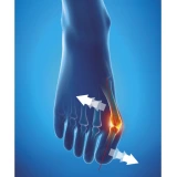 Epitact Hallux Valgus Orthèse Corrective de Nuit