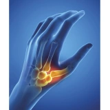 Epitact Orthèse de Pouce Souple d'Activité Rhizathrose