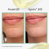 Eucerin DermoPure Sérum Triple Action