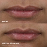 ROC Lip Volumizer