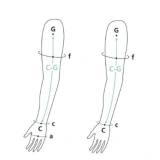 Sigvaris Advance Manchon de Compression Médicale Classe 3
