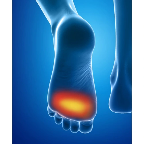 Epitact Coussinet Discret Epithelium 26