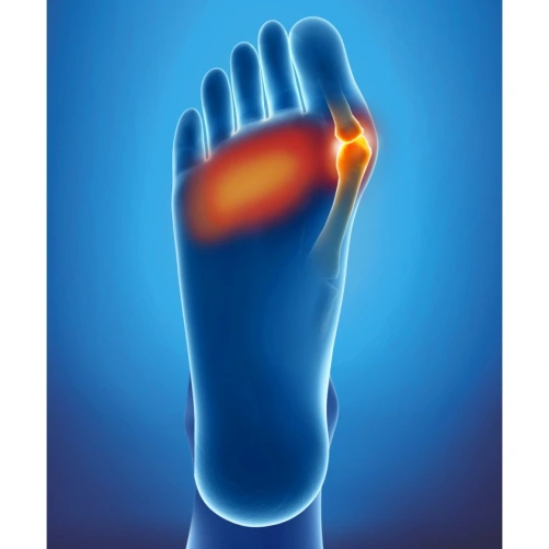 Epitact Orthèse Double Epithélium Flex+ Hallux Valgus
