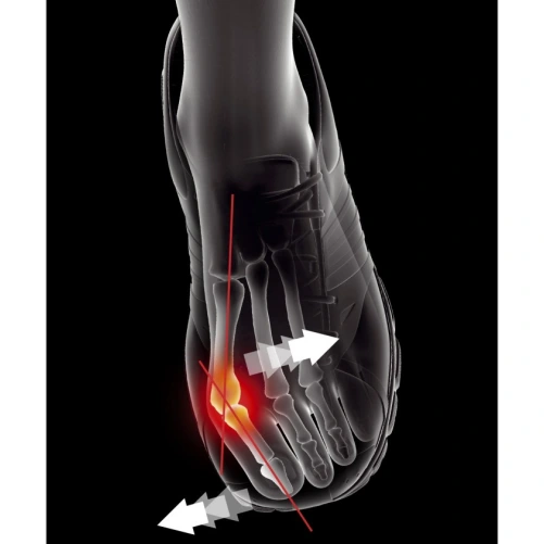 Epitact Orthèse Hallux Valgus