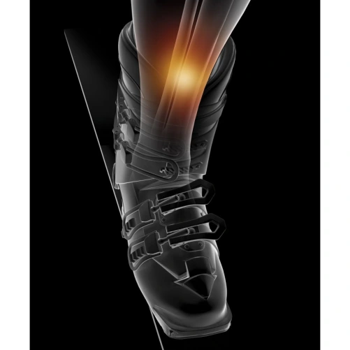 Epitact Protection Tibiales