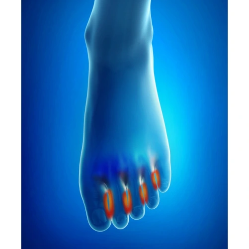 Epitact Séparateurs à l'Épithélium