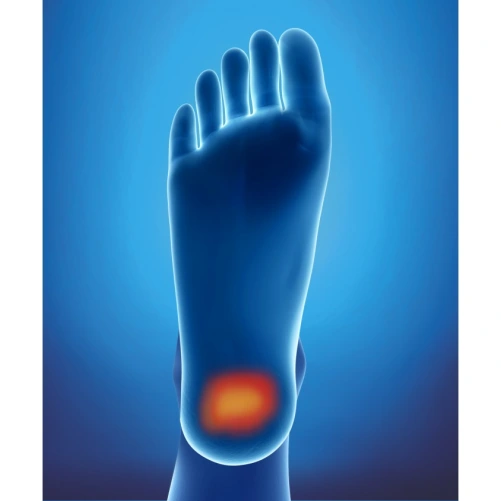 Epitact Talonnettes Physio Choc Épine Calcanéenne