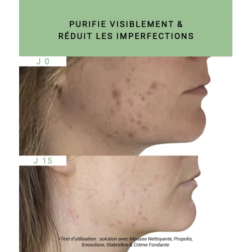 Etat Pur Propolis Teint Brouillé