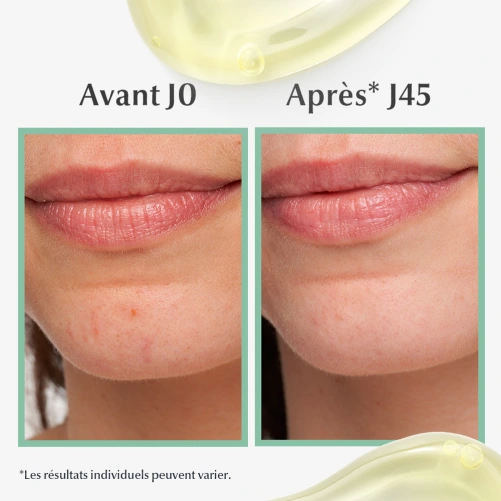 Eucerin DermoPure Sérum Triple Action