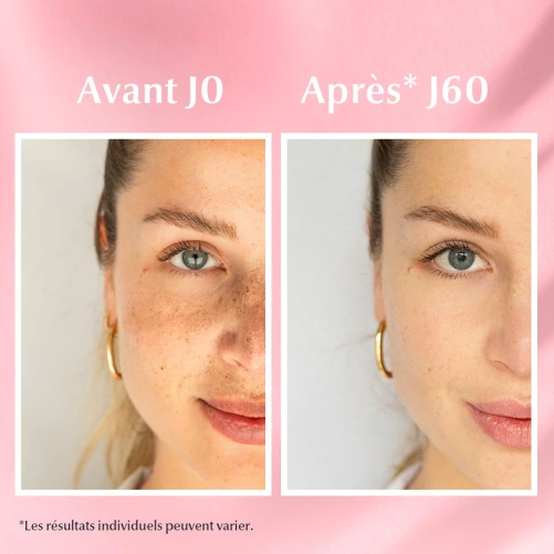 Eucerin Sérum Duo Anti-Pigment