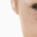 Anti-tache et dépigmentants