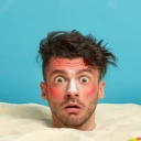 Brûlures, coups de soleil