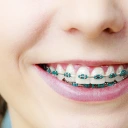 Entretien appareil et prothèse dentaire