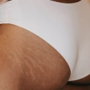 Soin anti-cellulite et vergetures