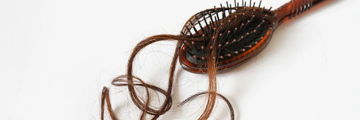Perte de cheveux